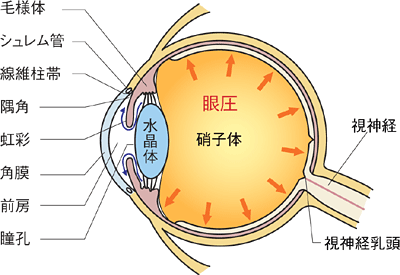 正常な眼球と白内障の眼球