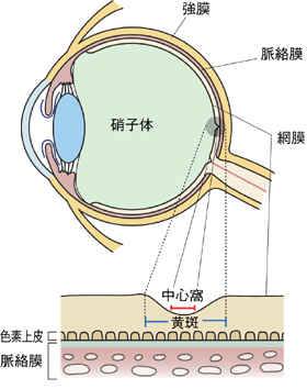 加齢黄斑変性の見え方